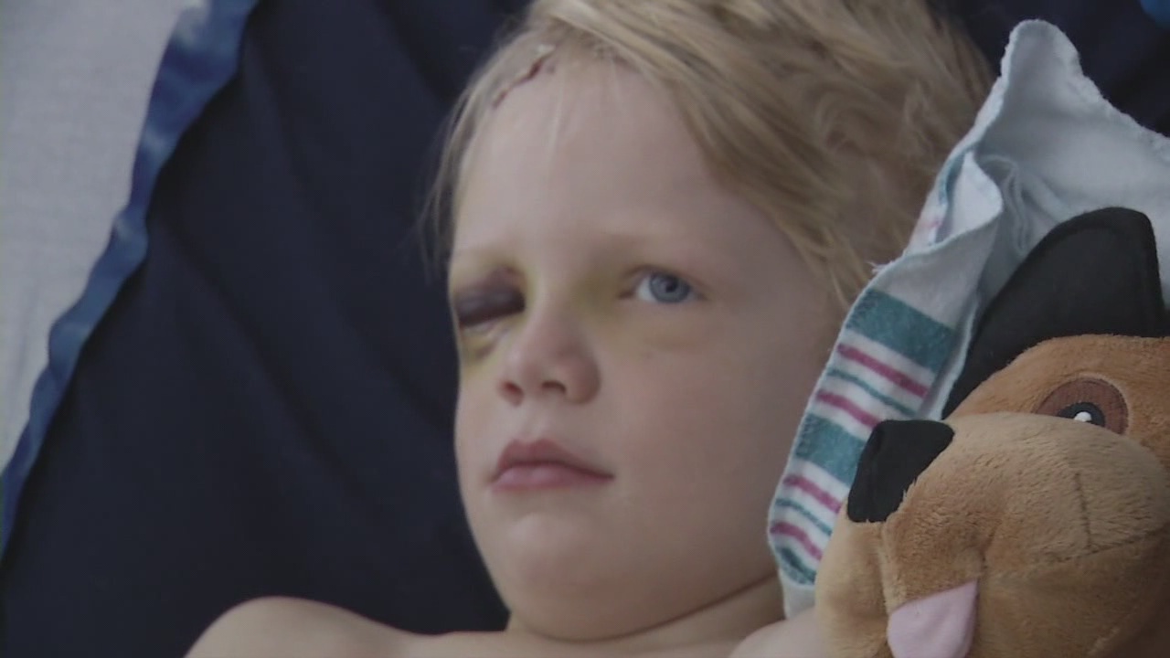 toddler hit by 100mph baseball now
