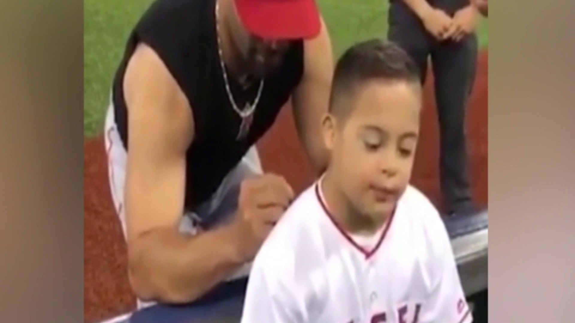 Albert Pujols - My Daughter has Down syndrome. Over the past