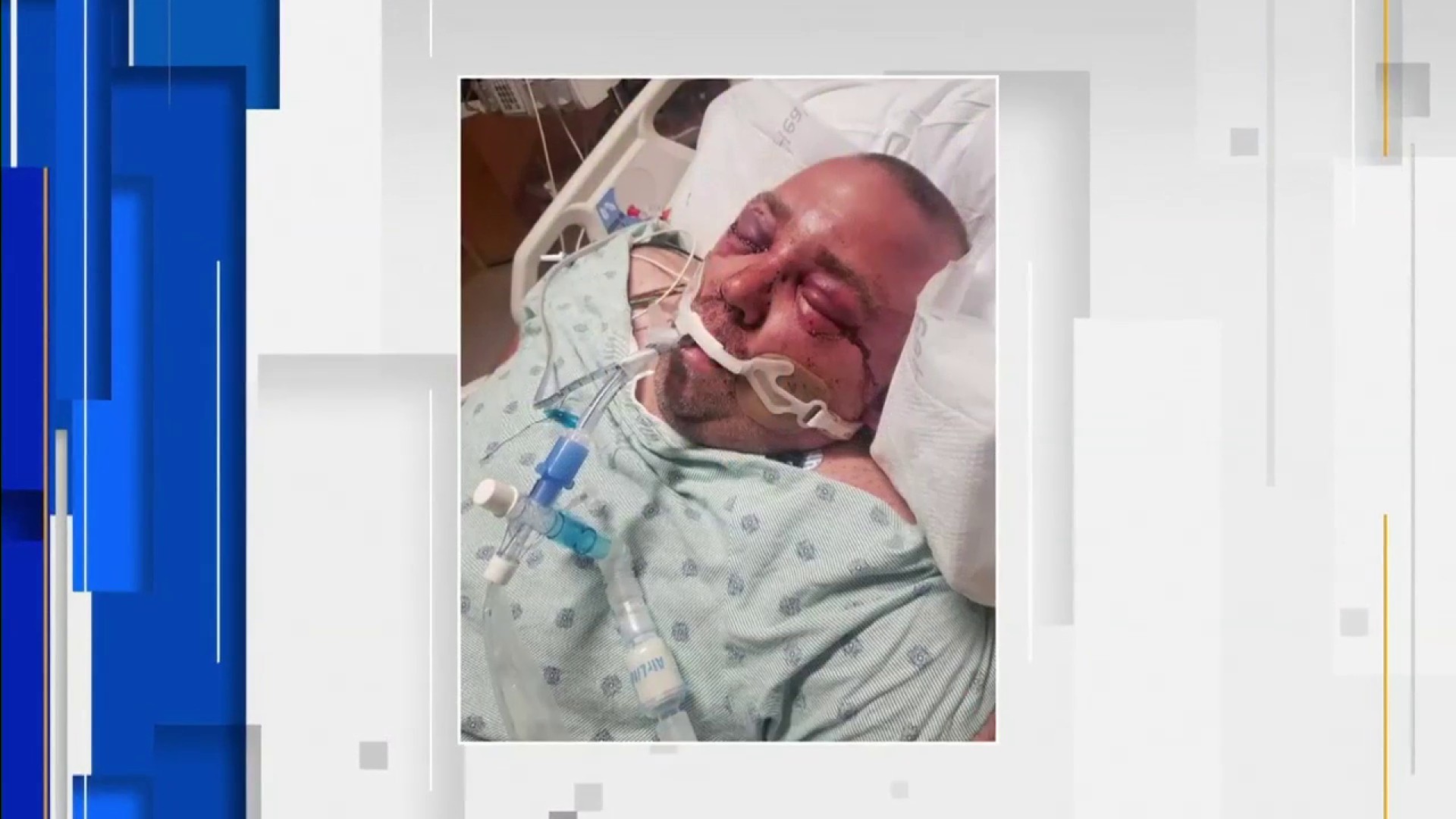 Hollywood beating victim remains hospitalized as family members push police  for answers